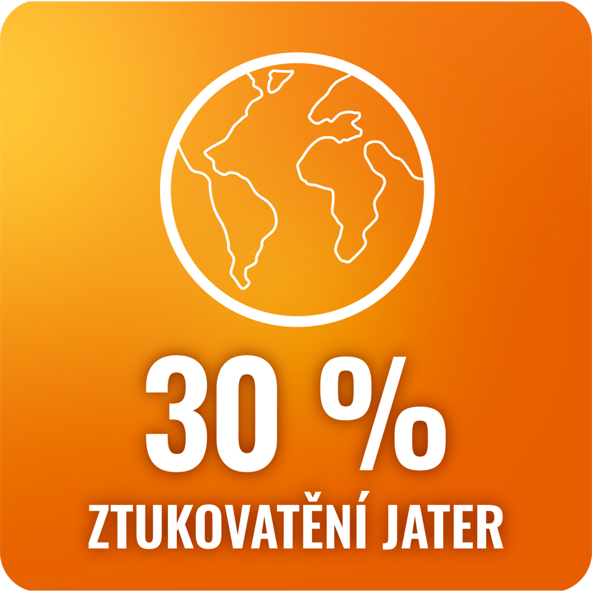 Infografika – 30 % dospělých lidí trpí ztukovatěním jater