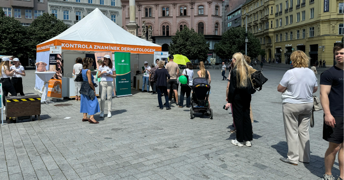 SKINCHECKER: Kontrola mateřských znamének na náměstí Svobody v Brně