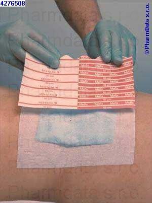 Mefix 2,5cm x 10m, 1 ks, hypoalergenní fixace