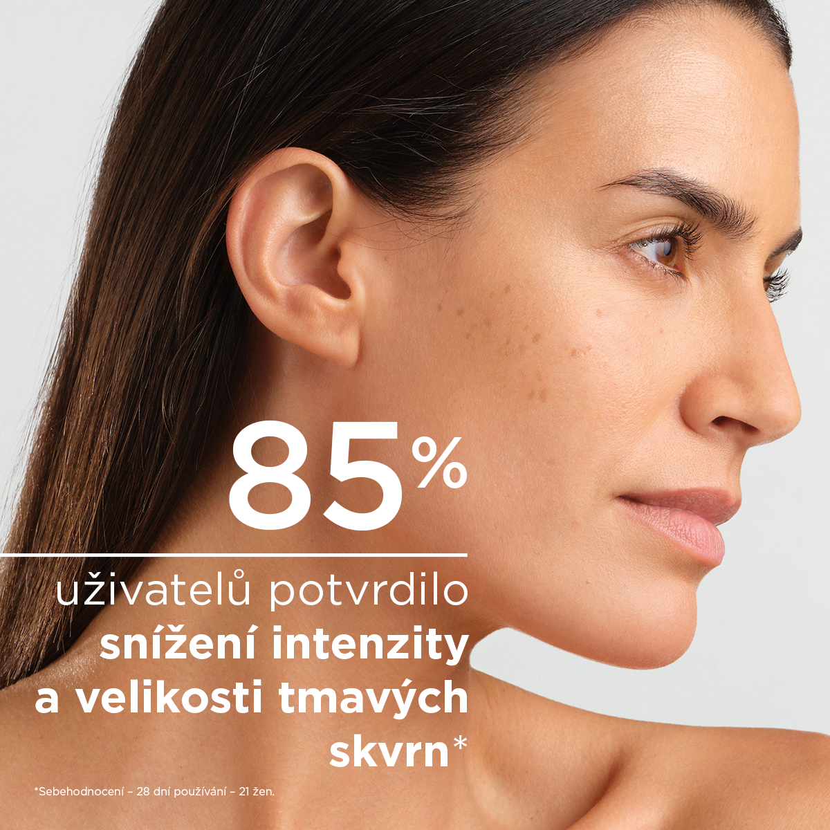 BIODERMA Pigmentbio C-koncentrát pomáhá snižovat intenzitu a velikost tmavých skvrn